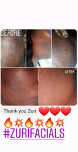 Load image into Gallery viewer, Zuri's Acne Milk Toner - Large ((DOES NOT Contain Dairy))