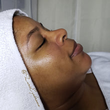 Load image into Gallery viewer, Zuri's Acne Milk Toner - Large ((DOES NOT Contain Dairy))