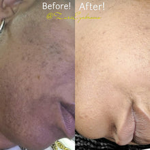 Load image into Gallery viewer, Zuri's D.I.R.T. Acne Exfoliating Scrub Treatment ((Product DOES NOT Contain Dirt))