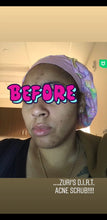 Load image into Gallery viewer, Zuri's D.I.R.T. Acne Exfoliating Scrub Treatment ((Product DOES NOT Contain Dirt))