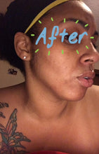 Load image into Gallery viewer, Zuri's D.I.R.T. Acne Exfoliating Scrub Treatment ((Product DOES NOT Contain Dirt))