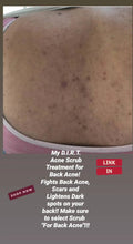 Load image into Gallery viewer, Zuri's D.I.R.T. Back Acne Scrub (For Back Acne ONLY!!)