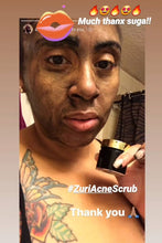 Load image into Gallery viewer, Zuri&#39;s D.I.R.T. Acne Exfoliating Scrub Treatment ((Product DOES NOT Contain Dirt))
