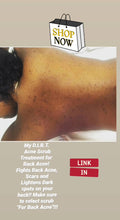 Load image into Gallery viewer, Zuri&#39;s D.I.R.T. Back Acne Scrub (For Back Acne ONLY!!)
